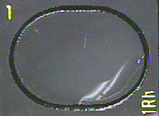 Photograph of a negative serologic test for <i>Shigella</i> showing no clumping of the bacteria.