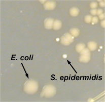 Photograph of a close up of <i>Escherichia coli</i> and <i>Staphylococcus epidermidis</i> growing on 
    TSA