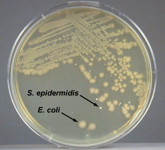 Photograph of an isolation plate: showing a mixture of <i>Escherichia 
    coli </i> and <i>Staphylococcus epidermidis</i> growing on TSA.