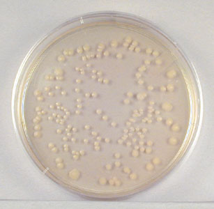 Photograph showing single isolated colonies 
    obtained during the plate count.