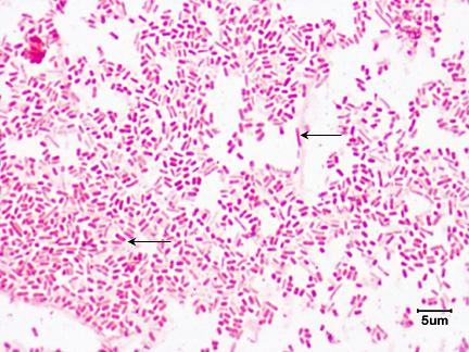 Photomicrograph of <i>Escherichia coli</i> showing bacillus shapes.