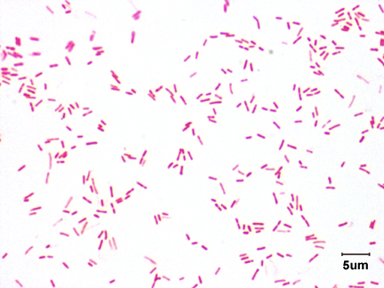 Photomicrograph of <i>Pseudomonas aeruginosa</i> showing bacillus shapes.