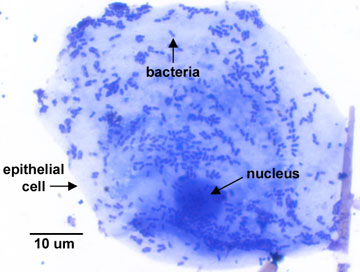 Photomicrograph of a stained mouth smear showing an epithelial cell covered with bacteria.