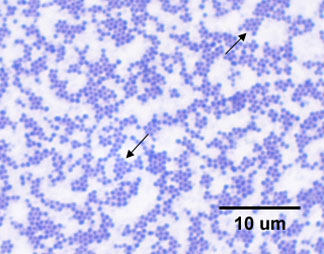 Photomicrograph of <i>Staphylococcus aureus</i> showing cocci with a staphylococcus arrangement.