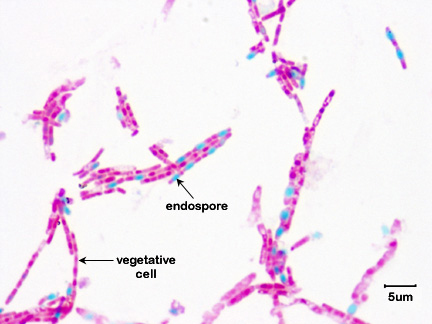Photomicrograph of <i>Bacillus megaterium</i> showing green endospores within red vegetative bacteria.