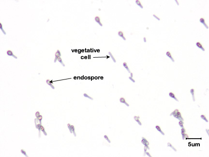 Photomicrograph of <i>Clostridium tetani</i> showing clear endospores within grey vegetative bacteria.