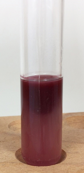 Photograph of a tube of motility test medium showing motile <i>Pseudomonas aeruginosa</i>. 