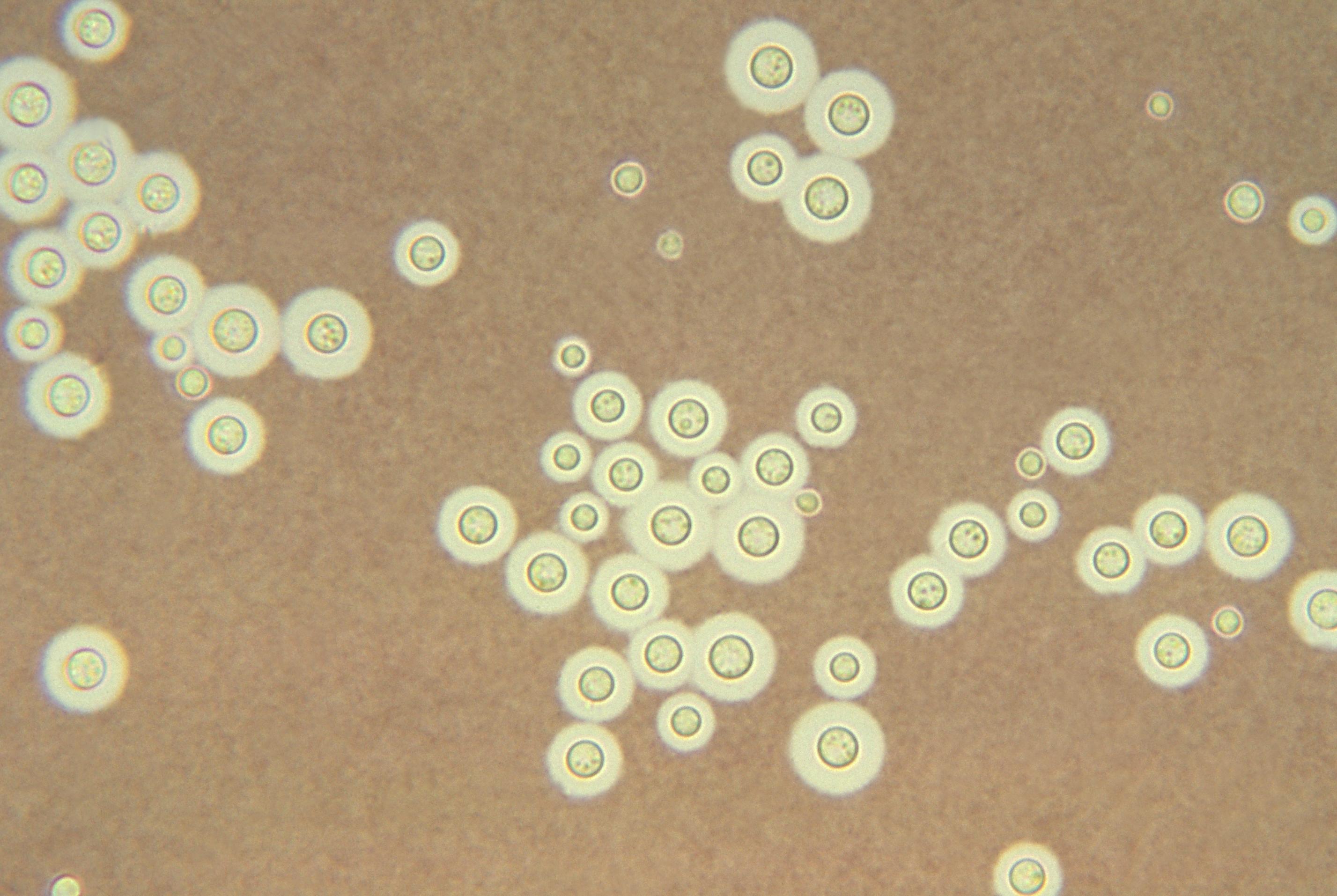 Photomicrograph of an India ink stain of encapsulated <EM>Cryptococcus 
    neoformans</EM> showing encapsulated yeast in spinal fluid.