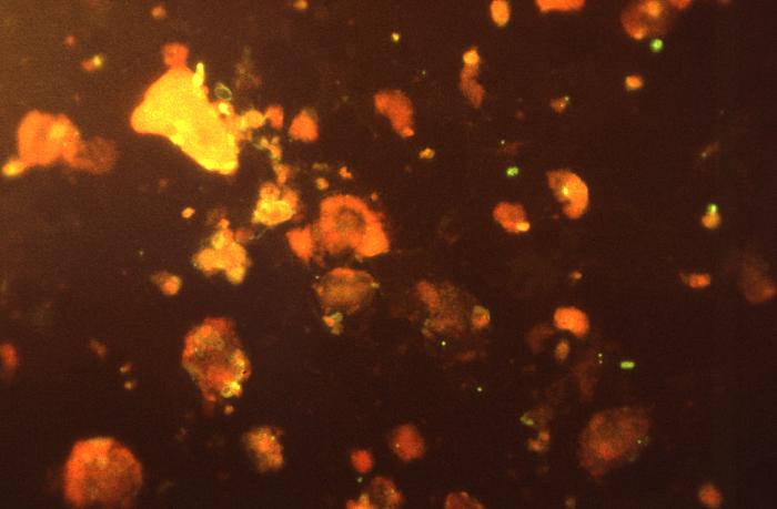 Photomicrograph of cysts of<EM> Pneumocystis 
    jiroveci</EM> from the lungs of a person with PCP