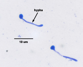 Photomicrograph of the dimorphic yeast <em>Candida albicans</em> 
      switching from a yeast form to a filamentous hyphal form.