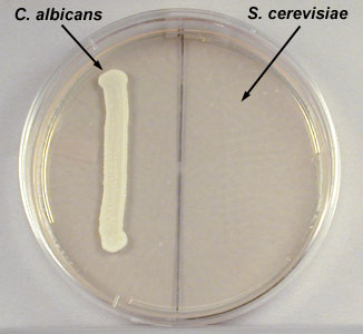 Photograph of <i>Candida albicans</i></EM> 
	  and <i>Saccharomyces cerevisiae</i> streaked on mycosel agar showing only <i>C. abicans</i> growing.