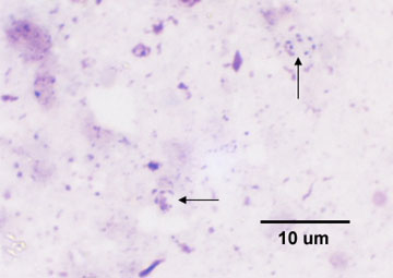 Photomicrograph of Cysts of <i>Pneumocystis jiroveci</i> from the Lungs of a Person with PCP