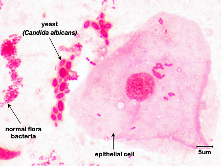 Photomicrograph of a mouth smear of a person 
    with thrush showing budding yeast.