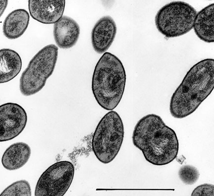 streptococcus pneumoniae electron micrograph