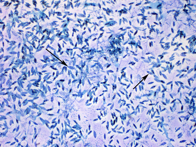 Macroconidia