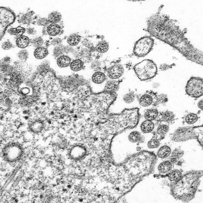 BIOL 230 Lecture Guide - Electron Micrograph Of SARS-C0V-2